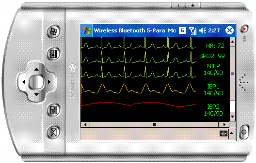 Sample Image - imate ECG.JPG