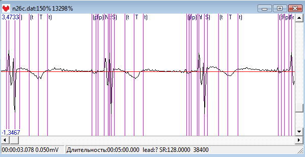 Screenshot - ecg.png