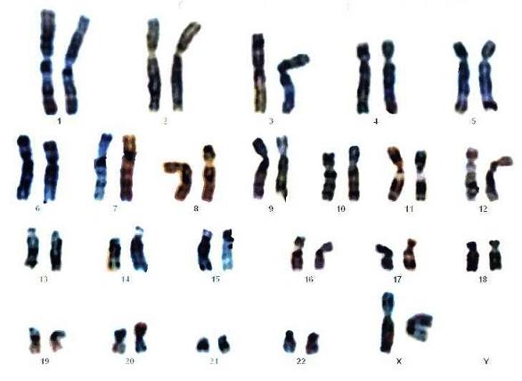 Chromosome